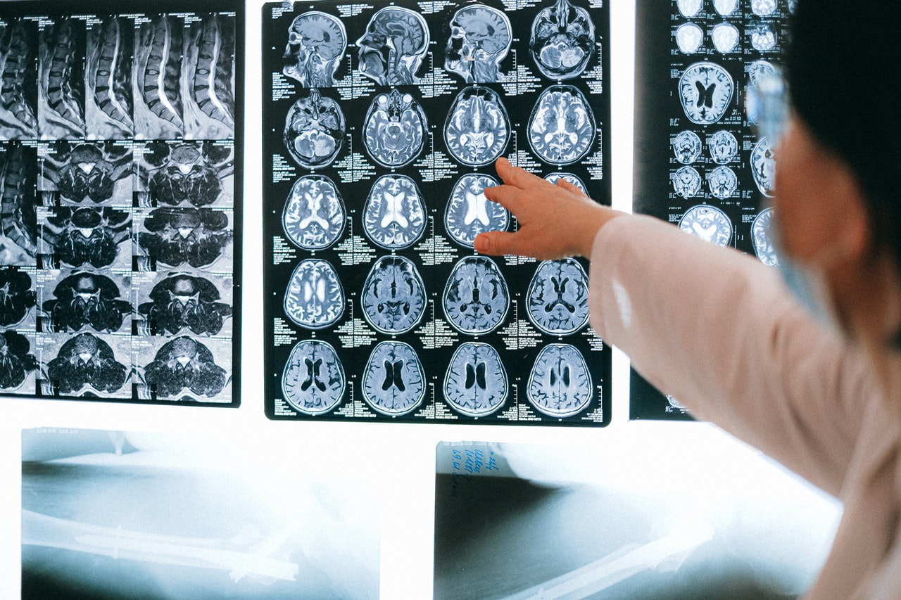4. Act Now: Top 8 Ways For Neuroscience Phds To Make An Impact