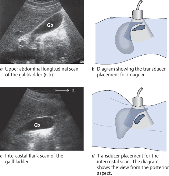 Pancreas Ultrasound Probe Positioning Transducer Placement Scanning Pancreas Ultrasound Probe Positioning Transducer Placement Scanning